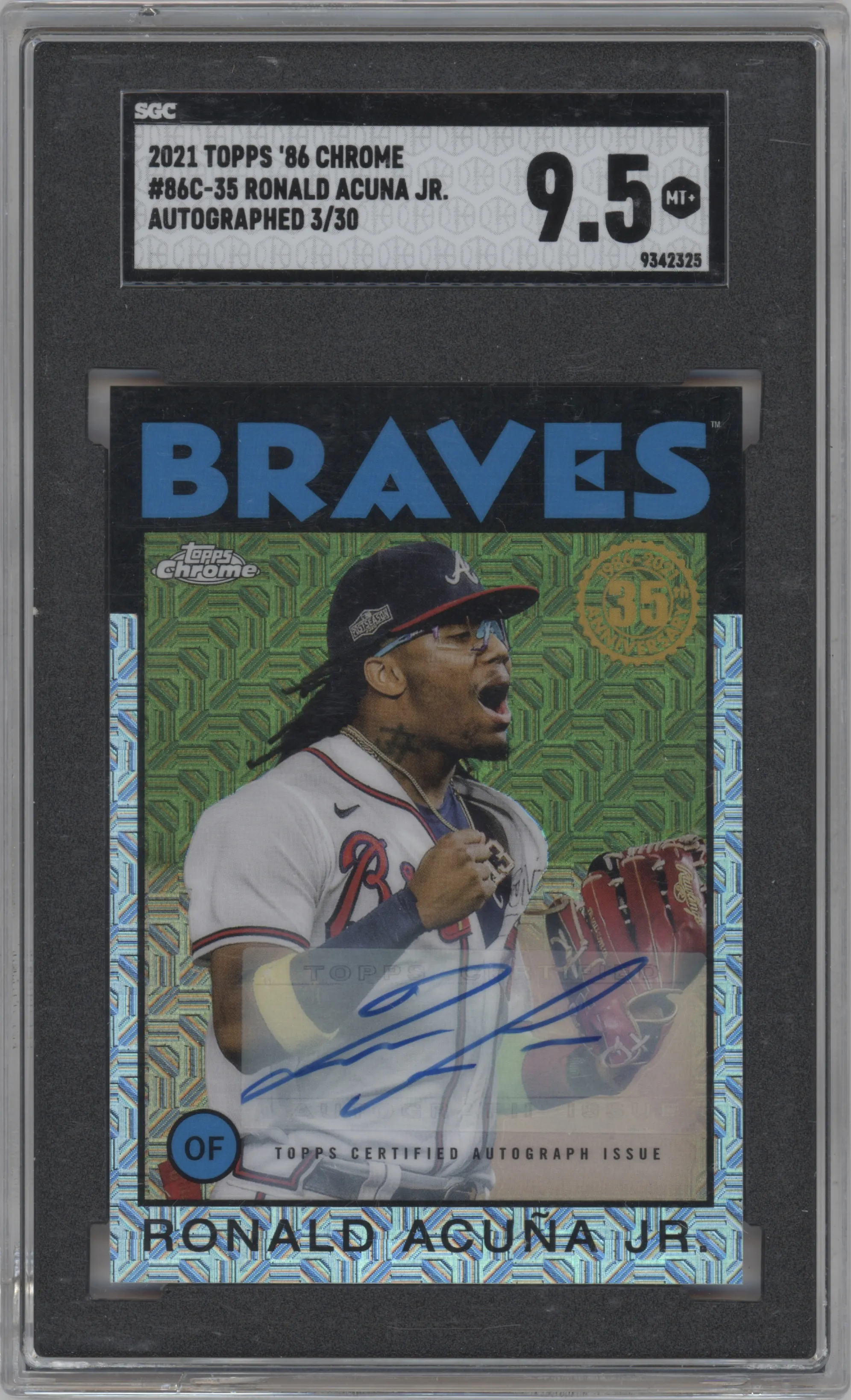 2021 Topps Silver Pack 1986 Topps Update Auto Ronald Acuna Jr. SGC 9.5